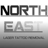 Northeast laser, inc.